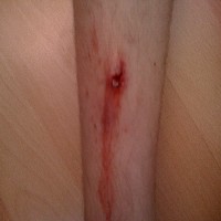 Shin